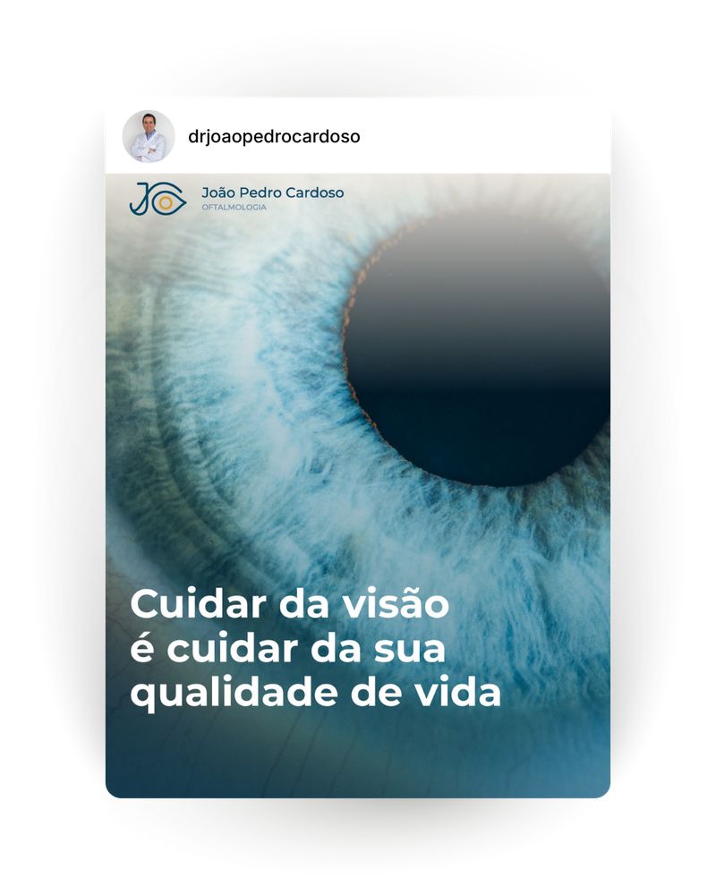 Post Instagram: Cuidar da visão é cuidar da sua qualidade de vida